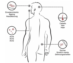 Dexpantenol Institute BCN Mesotherapy Serum, suero con microagujas para el crecimiento del cabello, estrías, acné y antienvejecimiento.