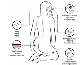 Tratamientos del Ácido Hialurónico 0,8% del Instituto BCN Serum Mesoterapia, Nano Micro Channeling Meso Serum. 